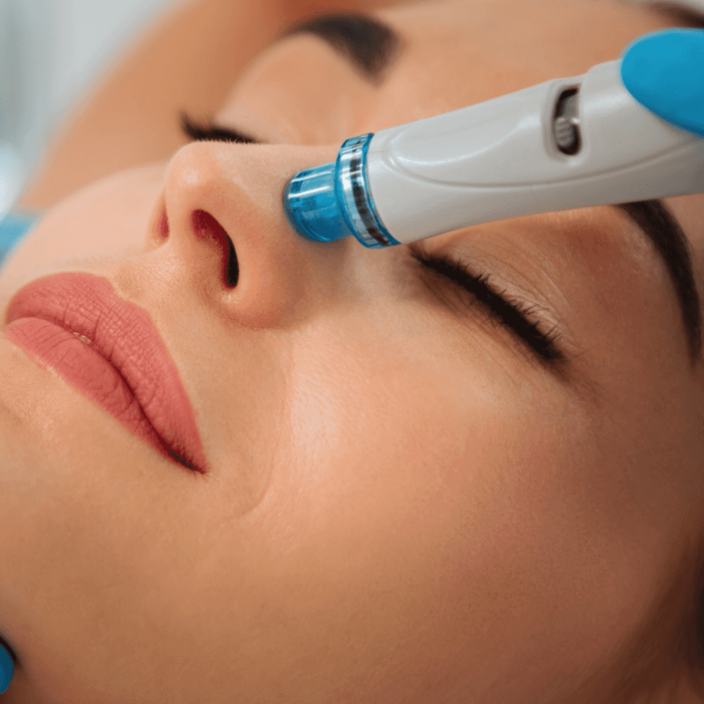 Microdermabrasion in Trussville, AL