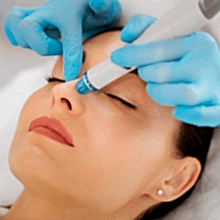 Microdermabrasion in Trussville